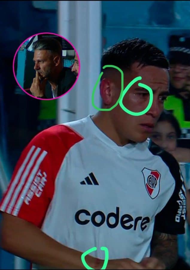 Esequiel Barco, con varias marcas de golpes en su cuerpo