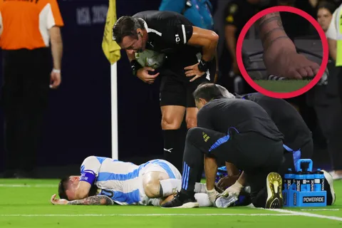 Copa América: ¿cómo le quedó el tobillo a Messi después de Argentina – Colombia?
