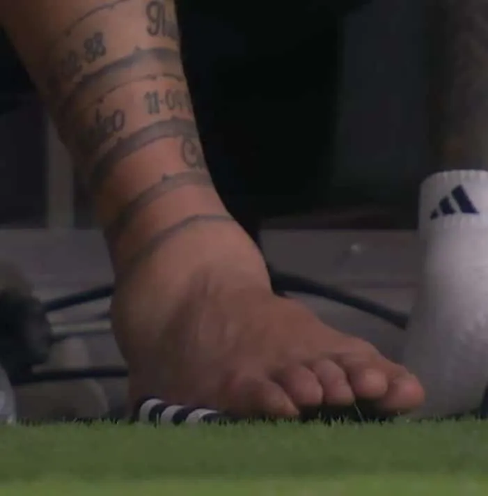 Así quedó el tobillo de Lionel Messi