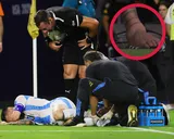 Copa América: ¿cómo le quedó el tobillo a Messi después de Argentina – Colombia?