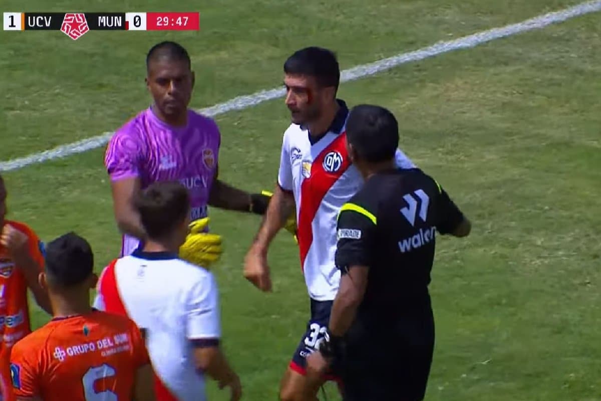 El impactante codazo que dejó ensangrentado a Facundo Pumpido de Deportivo Municipal